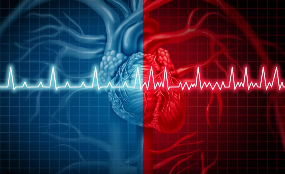 Understanding The Types of Heart Arrhythmia