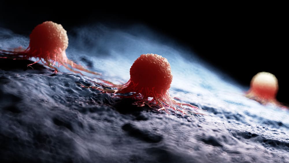 What You Need to Know About Benign vs Malignant Tumors