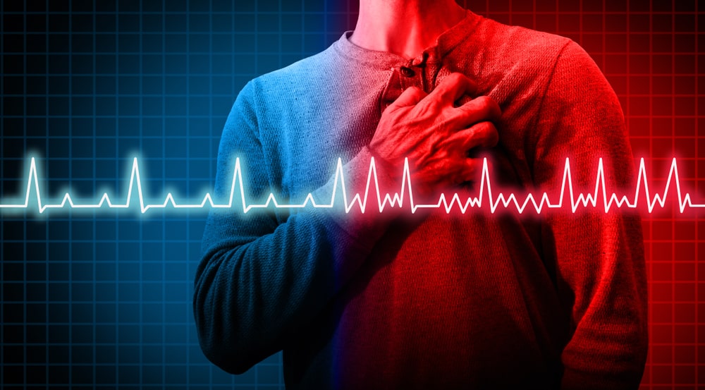 Heart Arrhythmia: All You Need to Know