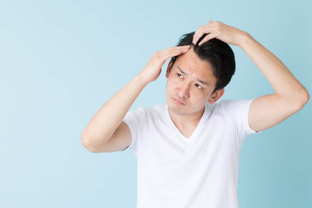 7 Natural Ways to Prevent Hair Loss in Men