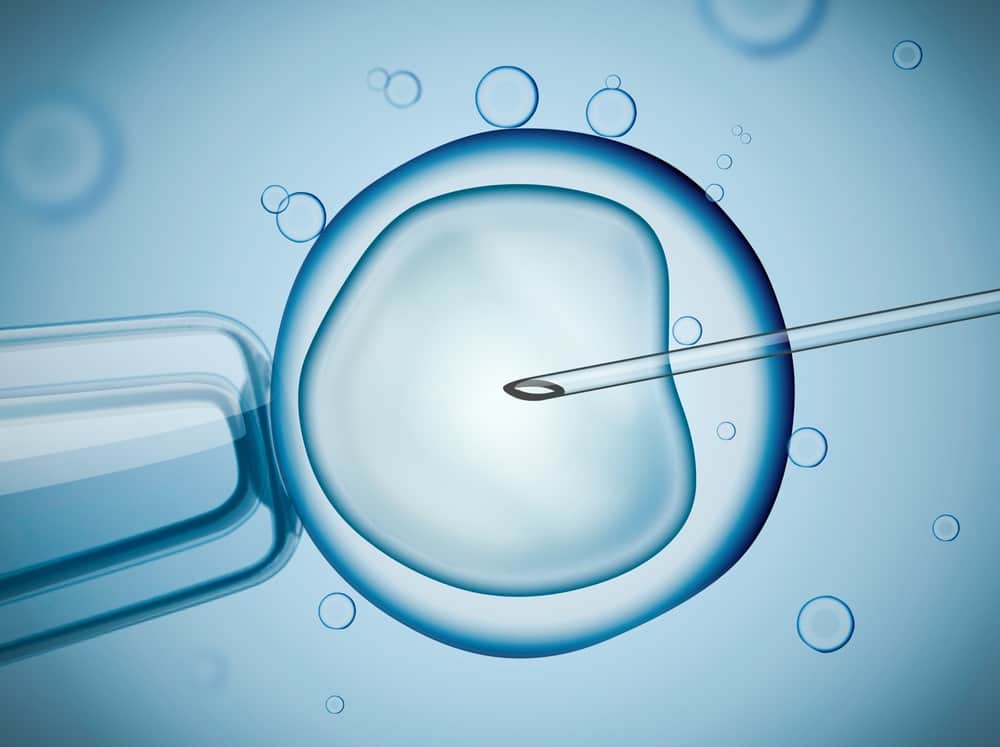IVF vs Artificial Insemination Which is Right for Me?