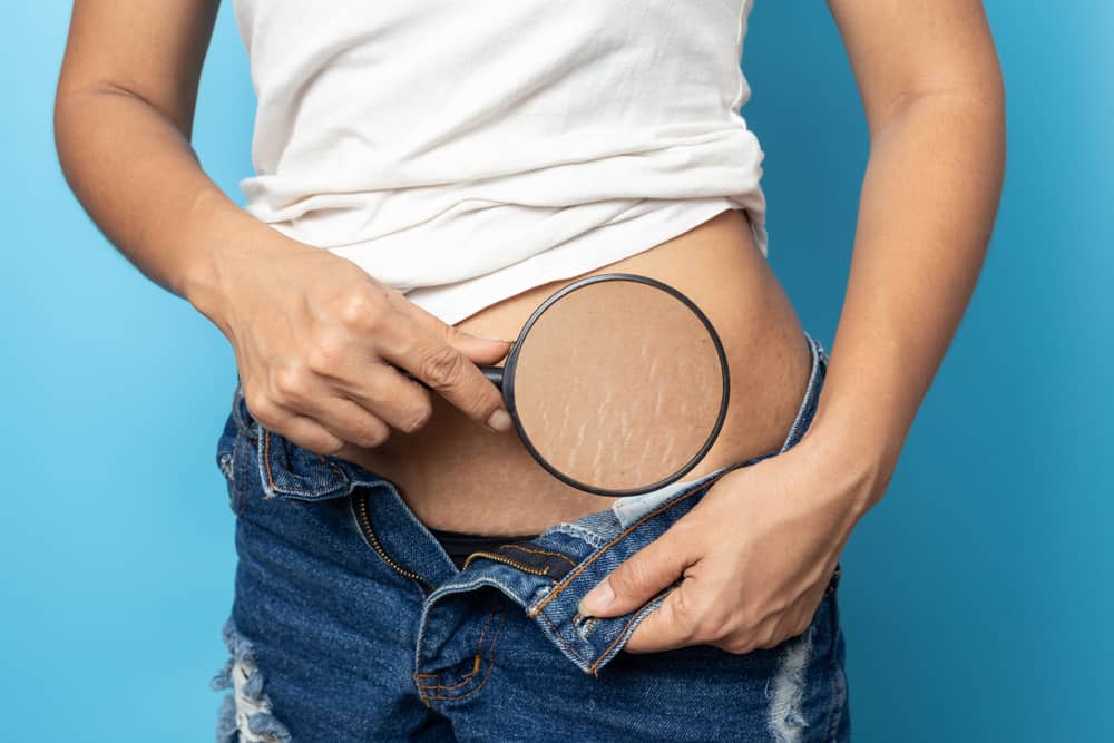 6 Ways a Woman's Body Changes After Giving Birth