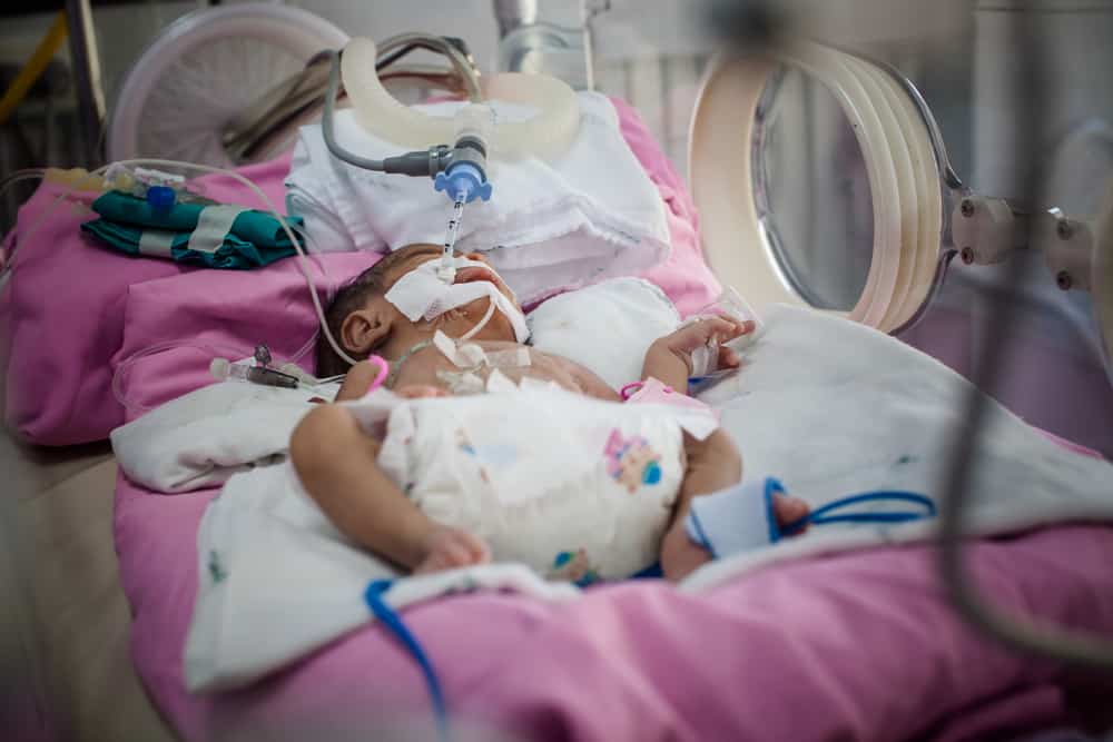 Everything You Need to Know About Neonatal Sepsis
