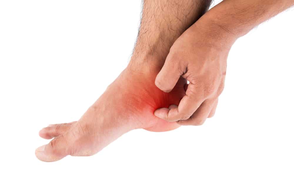 How To Treat Athlete's Foot: Important Tips To Remember