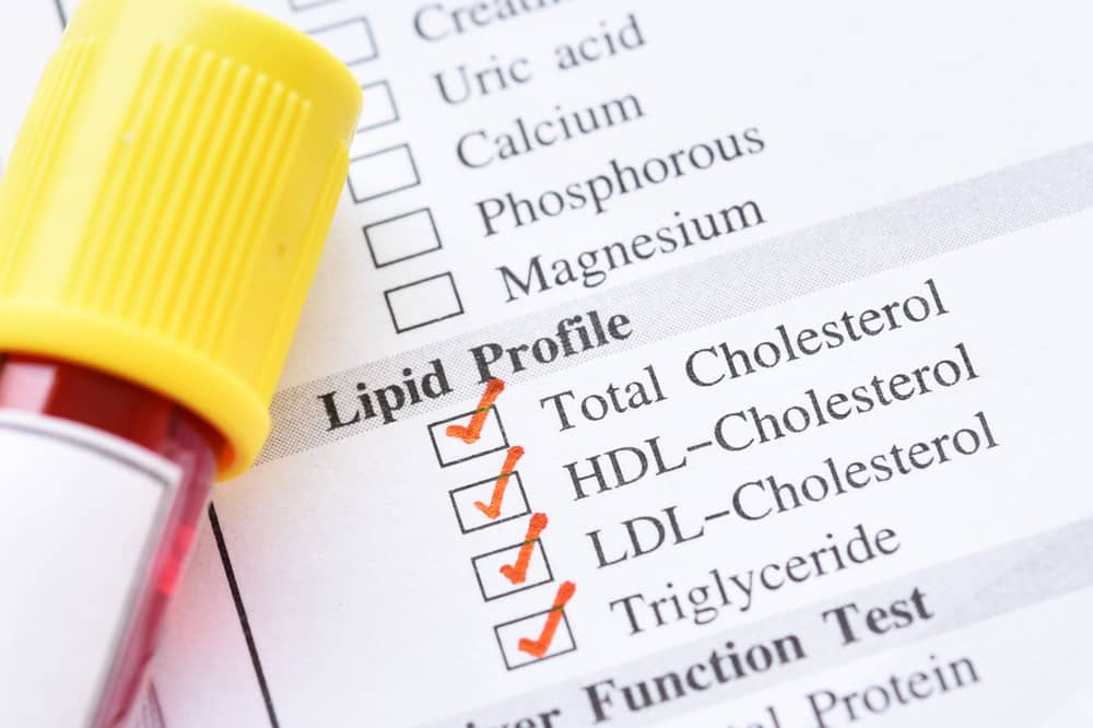 Cholesterol Test: Procedure and Results