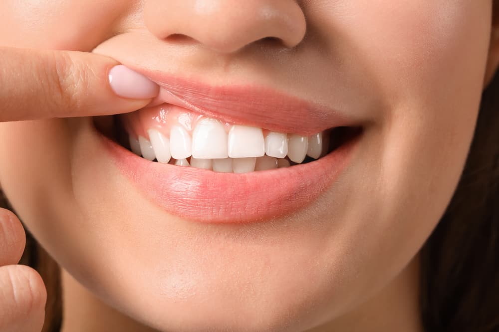 What Habits Can Help Keep Teeth and Gums Healthy?
