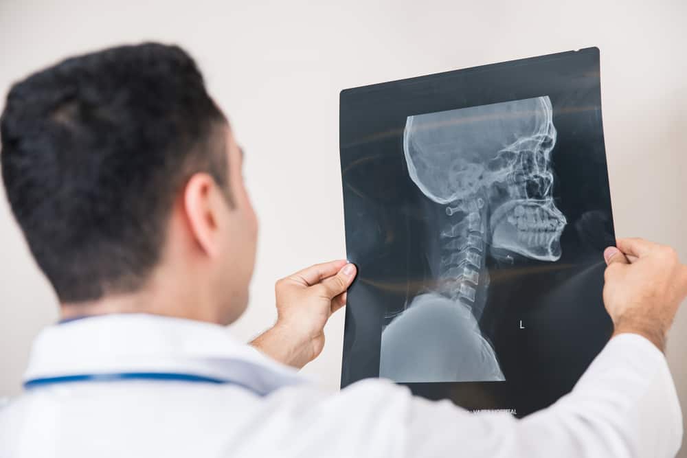 Symptoms of Brain Injury After Hitting Head