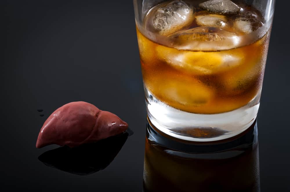 Alcoholic Liver Disease Prevention: What You Can Do