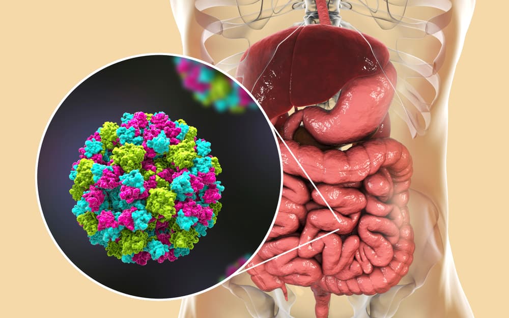 Acute Gastroenteritis With Moderate Dehydration: Should I Be Worried?