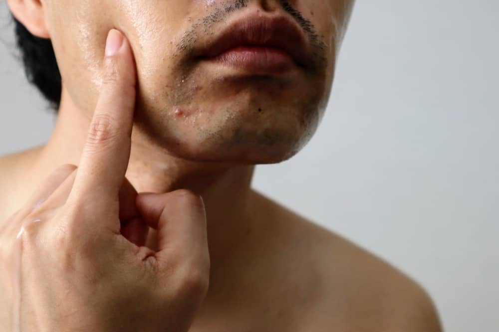 Signs and Symptoms of Common Skin Problems