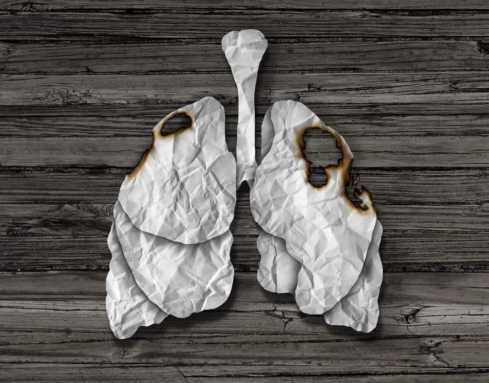 Is Lung Cancer Genetic?