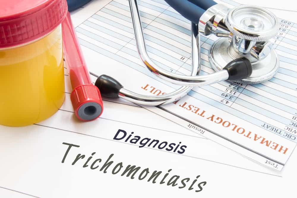 Trichomoniasis Discharge: How to Deal With Trich