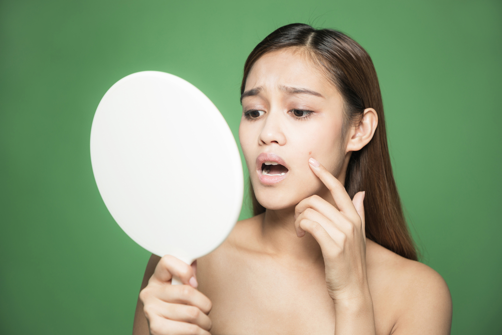 Acne Dos and Don'ts: How To Remove Pimples Safely