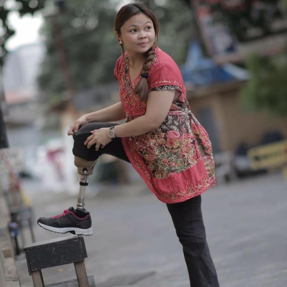 PWD Advocate Raissa Laurel-Subijano Shares Her Extraordinary Recovery After Bombing Incident