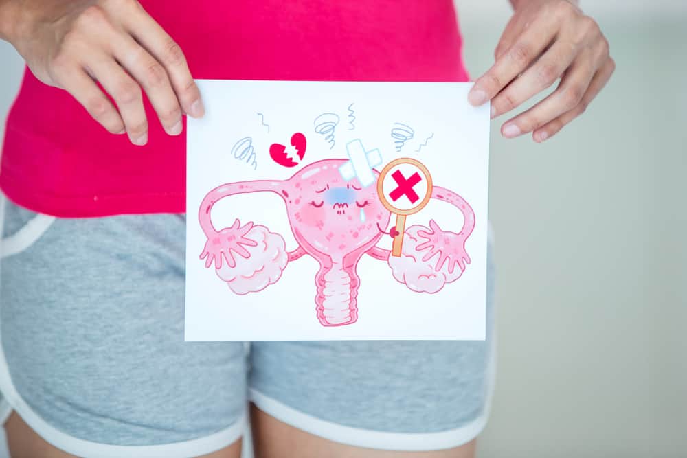 Cause of Ovarian Cancer: 5 Things You Need to Know