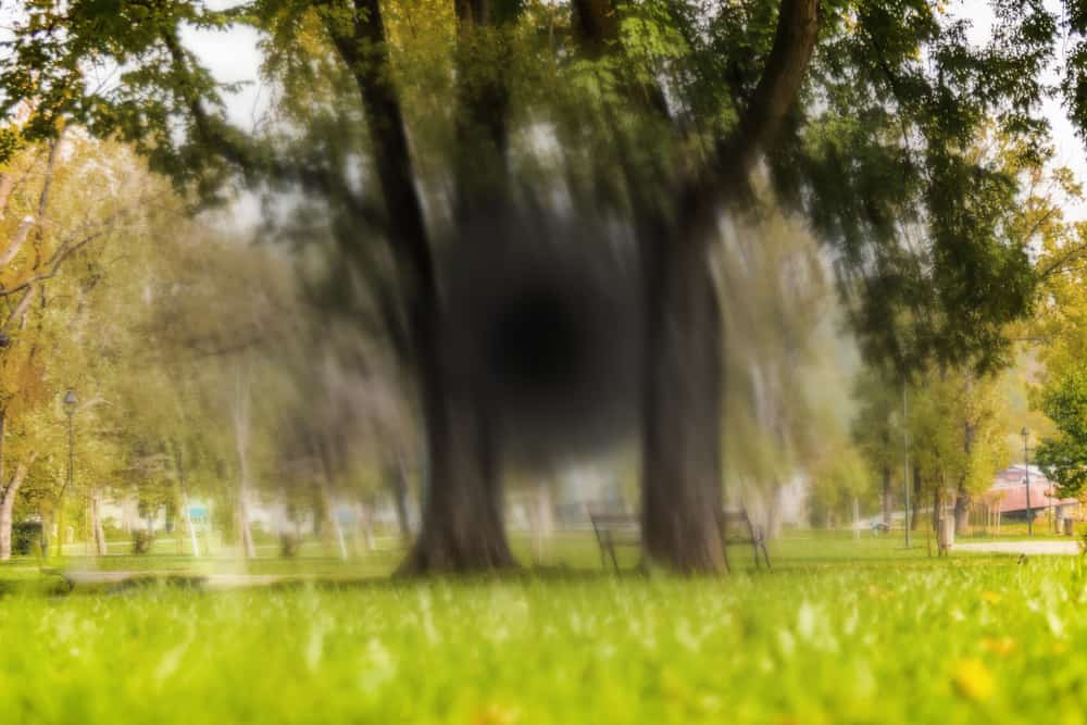 Macular Degeneration Causes and Symptoms: Can it Be Treated?