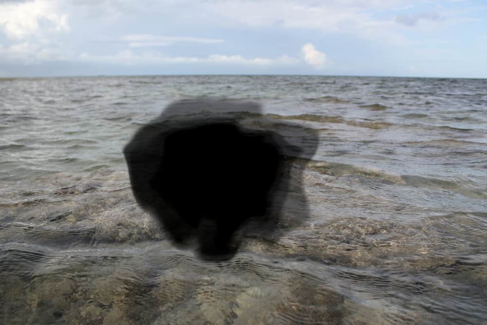 Maculopathy Signs and Symptoms: How to Spot the Condition