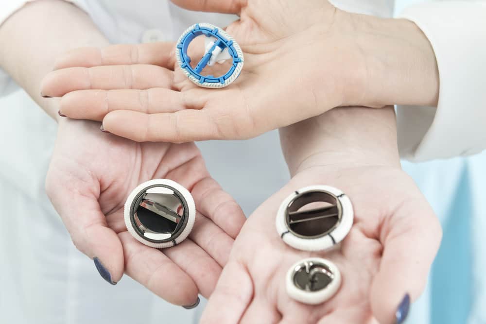 Heart Valve Replacement: What is it and How is it Done?