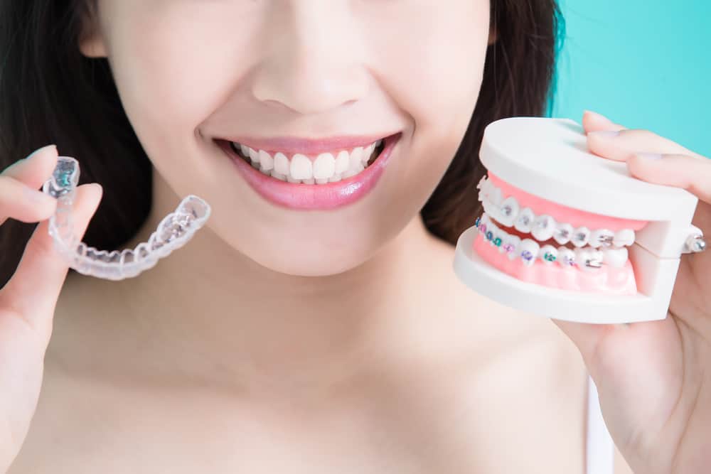 What to Expect if You're Getting Dental Braces