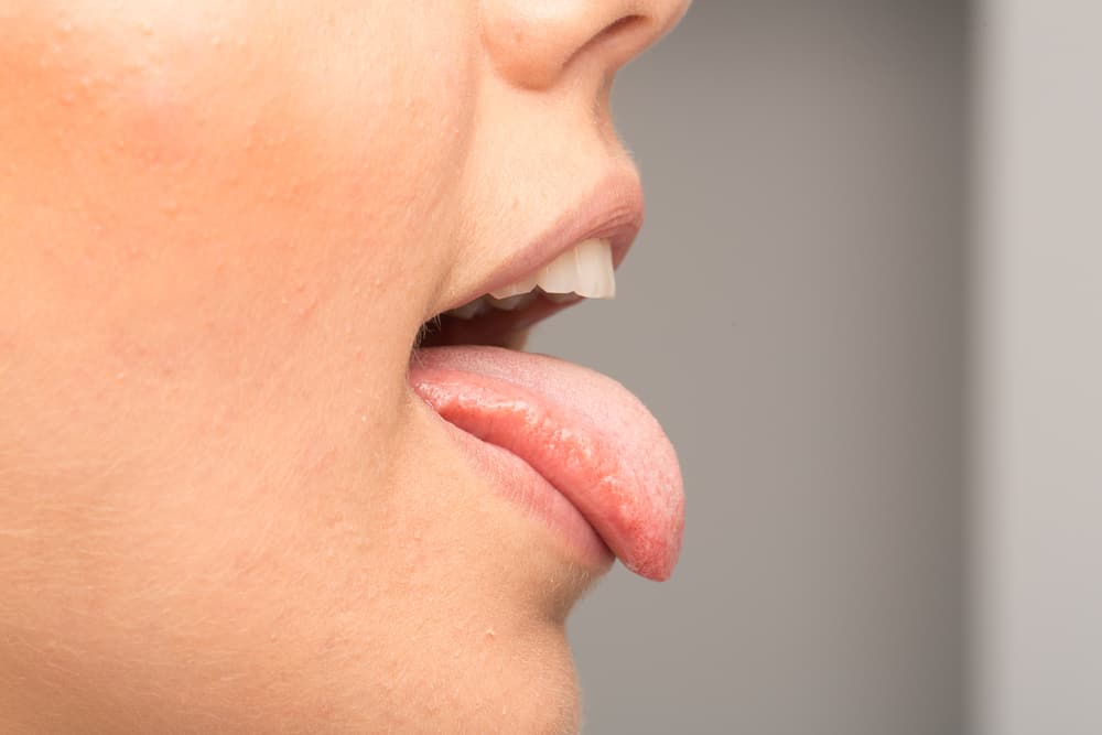 Can AIDS Be Transmitted Through Saliva? Find Out the Answer Here