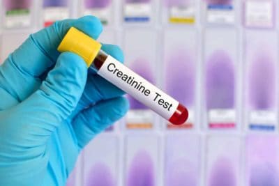 What Do High and Low Creatinine Levels Indicate?