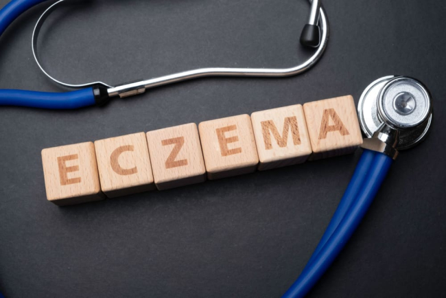 Long Term Prognosis for Eczema: Implications and Management