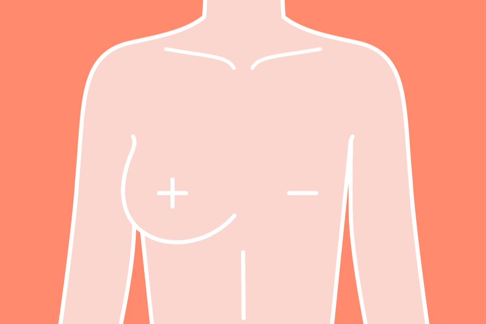 Your Definitive Guide To The Types of Mastectomy