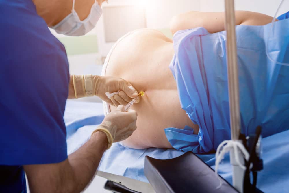 Epidural vs Natural Birth: What are the Pros and Cons?
