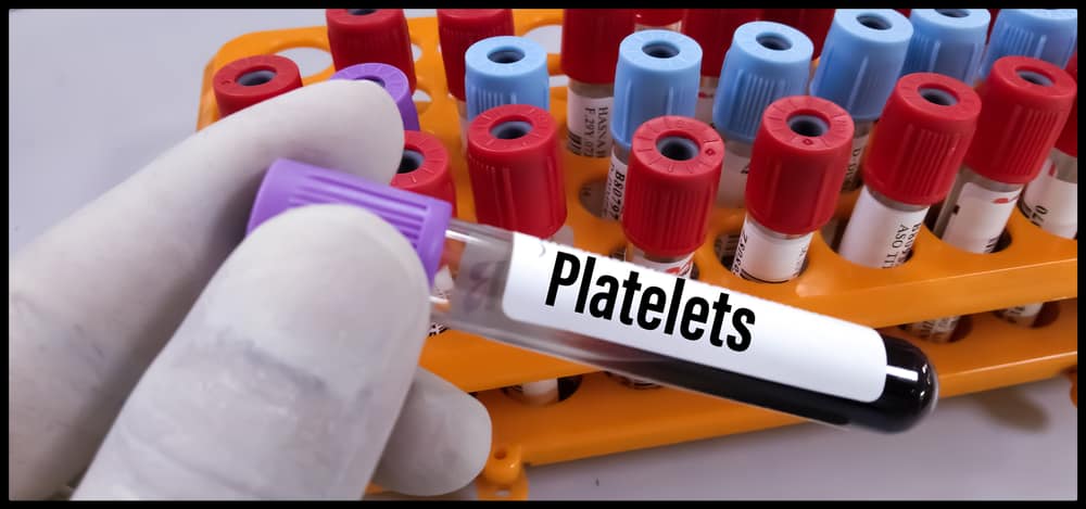 Low Platelet Count? How to Increase Platelet Count in Dengue