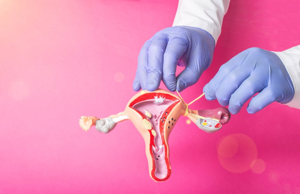 Tubal Ligation: What You Should Know Before Getting Your Tubes Tied