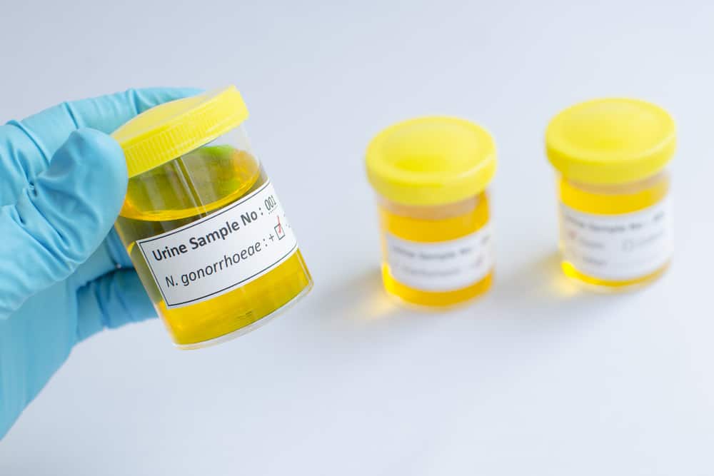 Do I Need a Gonorrhea Test? What Should I Do Next?