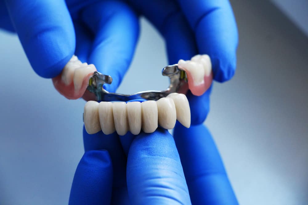 Dental Bridges: How Do They Help Align Your Bite?
