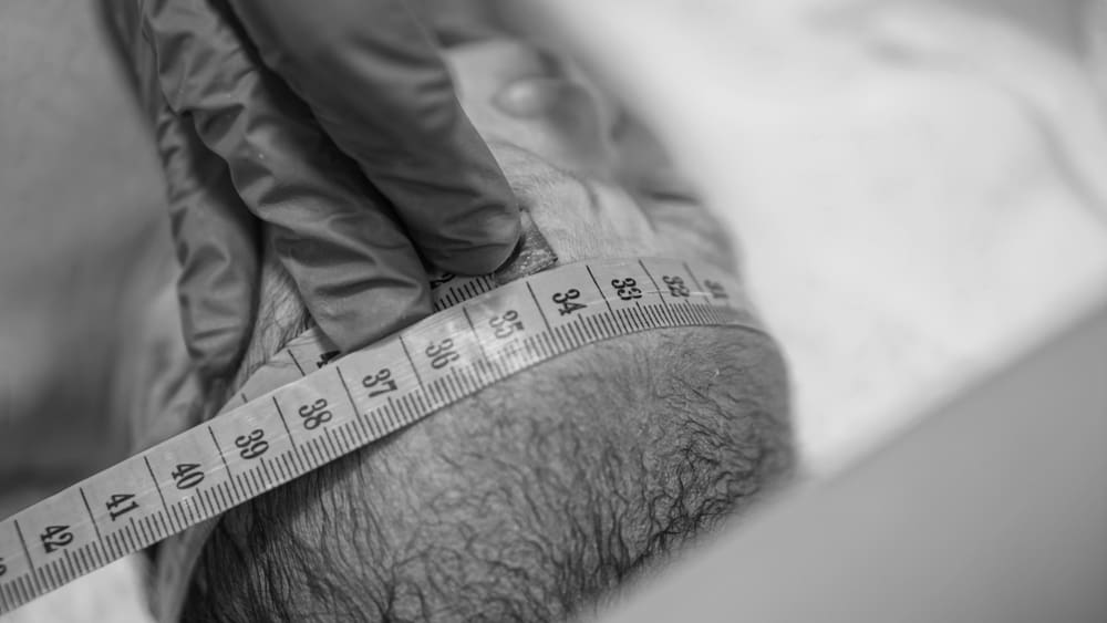 Hydrocephalus in Baby: Why Does it Occur and Can it be Prevented?