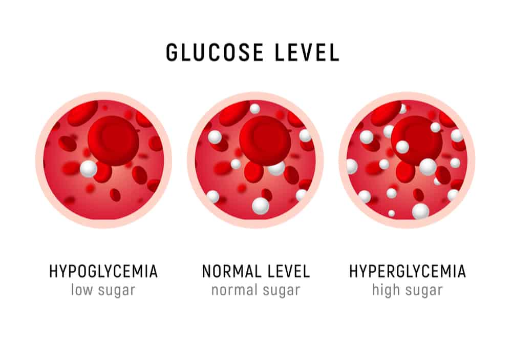 What is Hyperglycemia? Here Are the Symptoms and Treatments