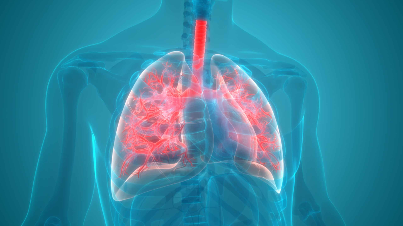 What are the 4 Stages of Pneumonia? Find Out Here