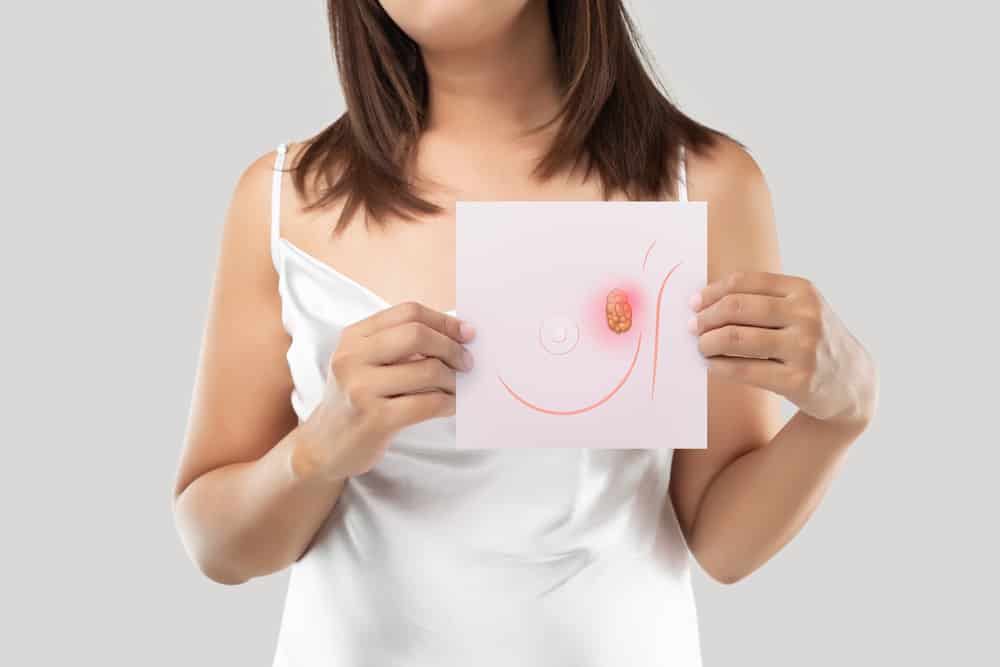 Nipple Discharge and Breast Cancer: What's the Connection?