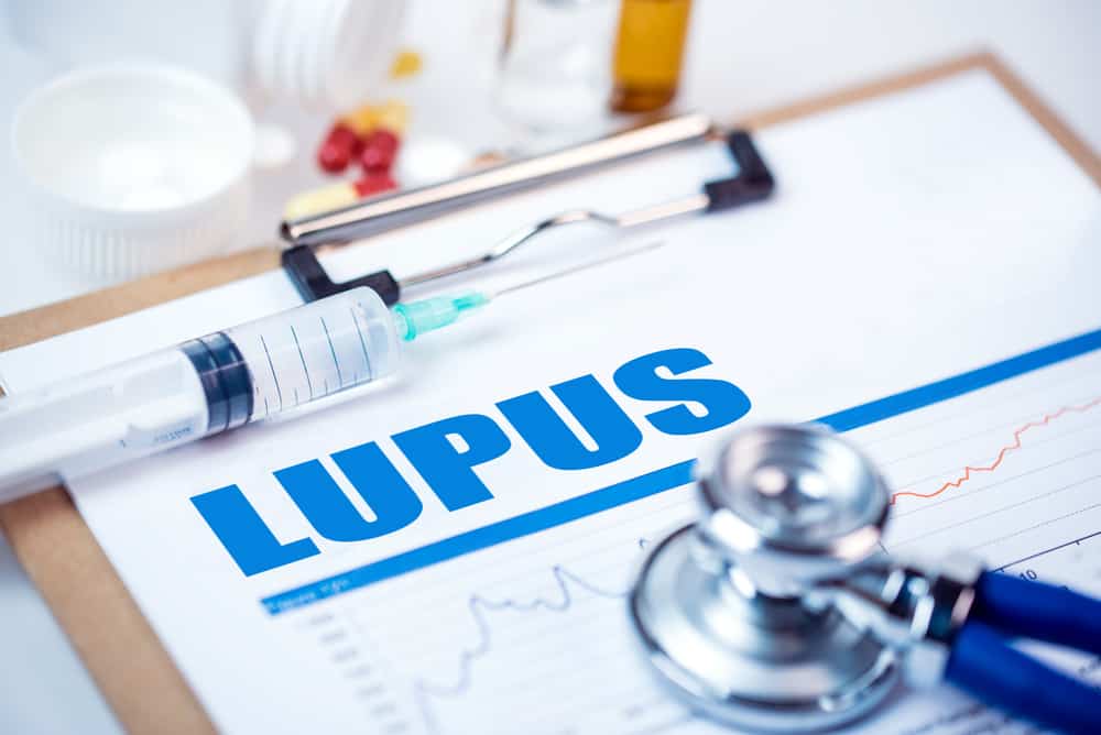 What is Lupus? Learn About Lupus Flares, Symptoms, and Treatment