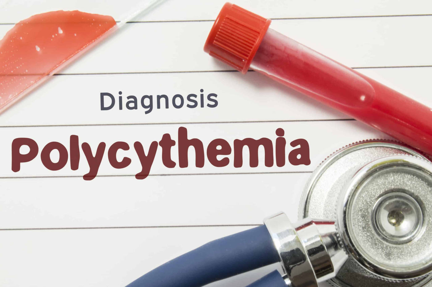 Polycythemia Vera Symptoms: When Blood Becomes Thicker