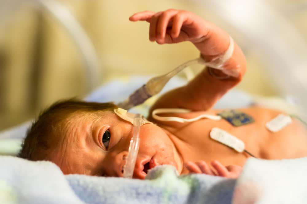 Microcephaly: Everything About the Rare Birth Defect