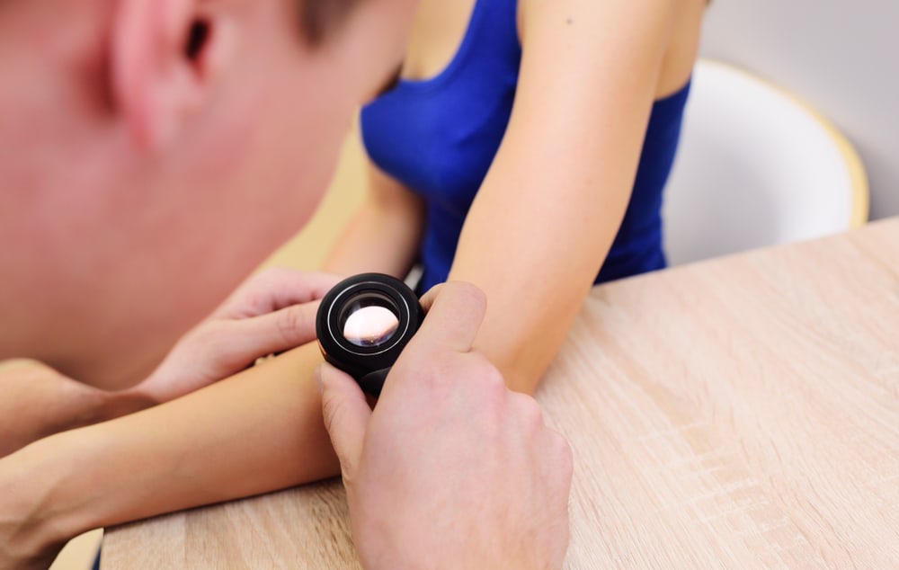 Stages of Melanoma Skin Cancer and Treatments