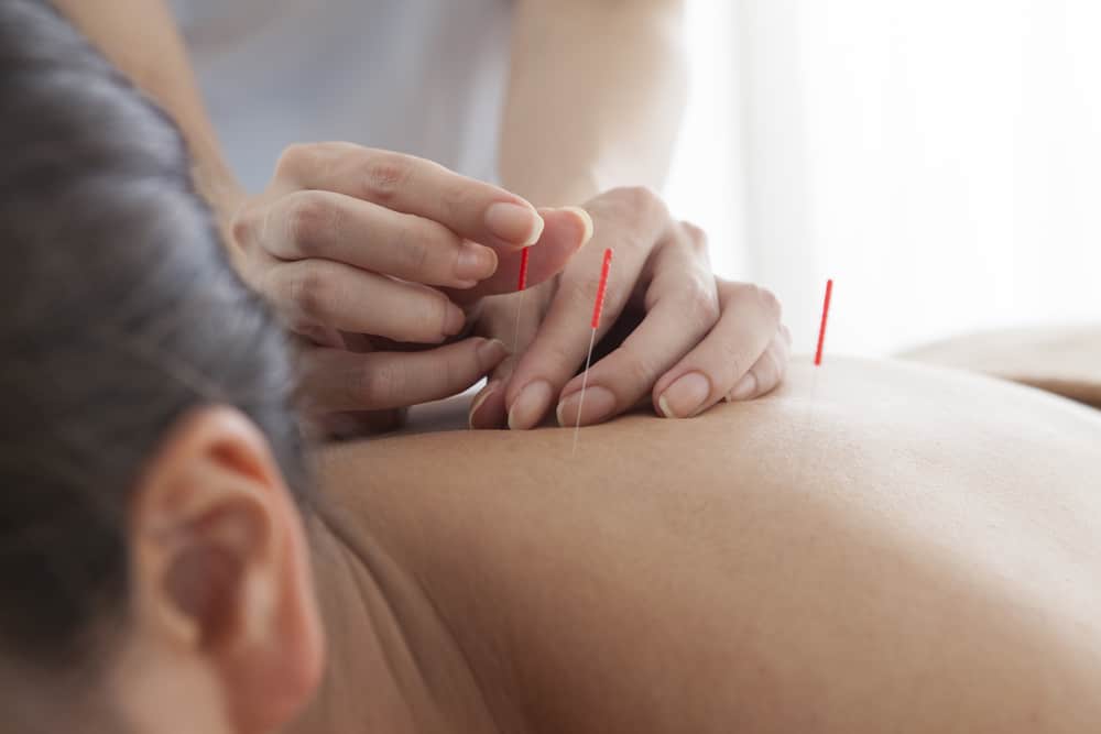 Acupuncture for Asthma: Does it Really Work?