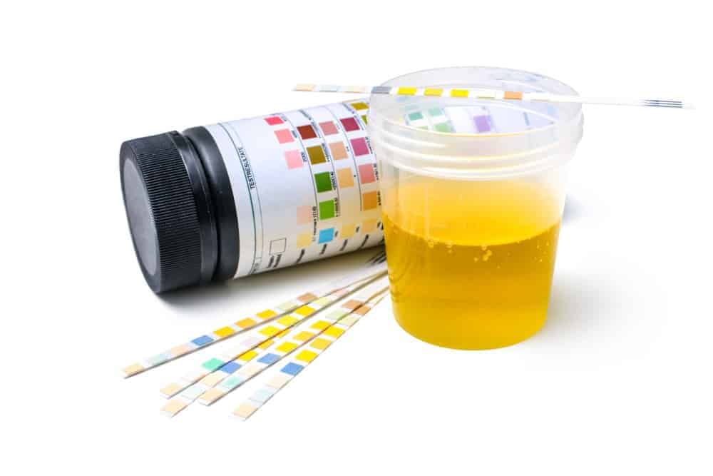 How To Collect Urine Sample A StepbyStep Guide