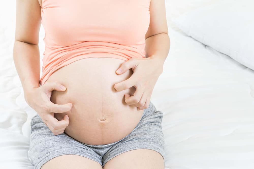 Itching During Pregnancy: Should You Be Worried?