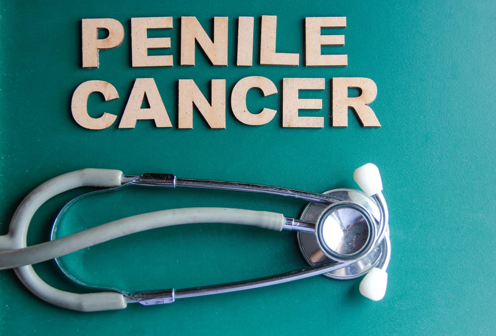 Penile Cancer Symptoms, Causes, Treatment, and Prevention