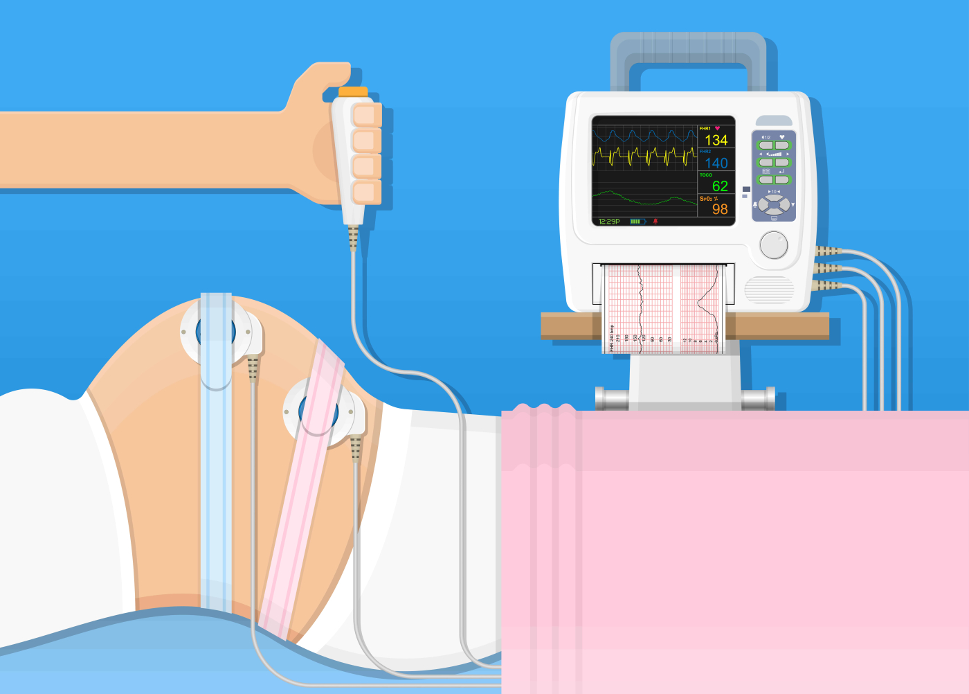 Nonstress Test (NST): Why and How is it Done?