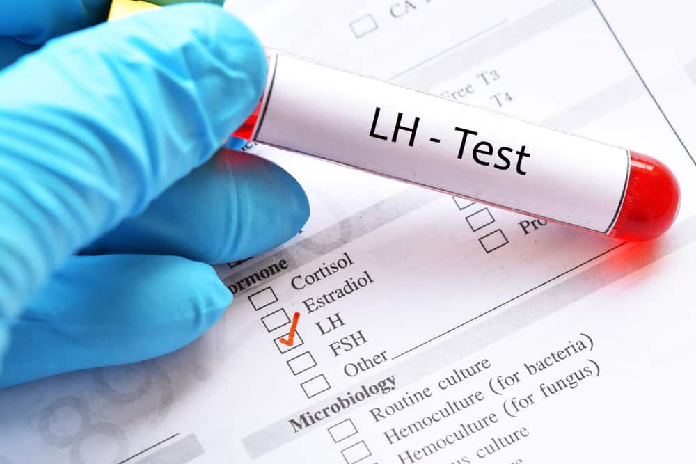 Luteinizing Hormone Test: Why and How is it Done?