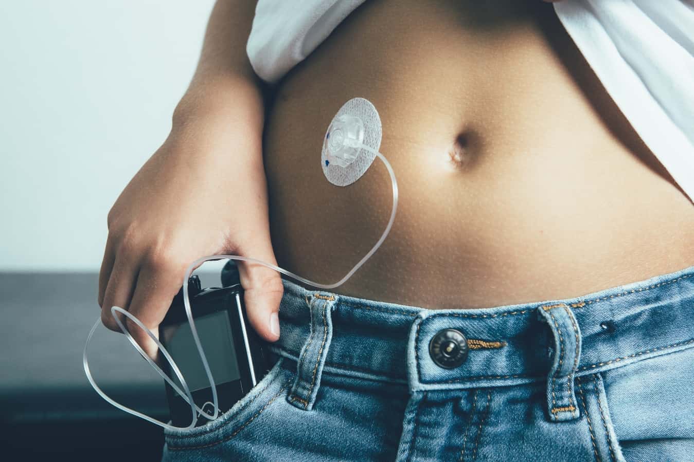 Insulin Pump Pros And Cons: Is It Right for You?