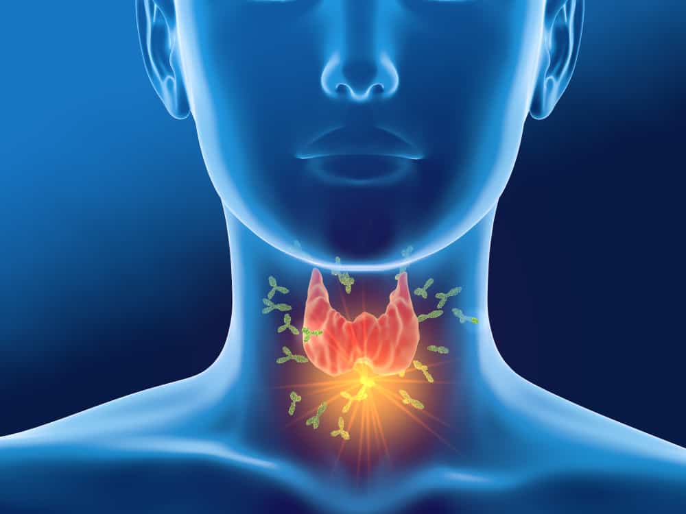 How to Detect the Symptoms of Hashimoto’s Thyroiditis