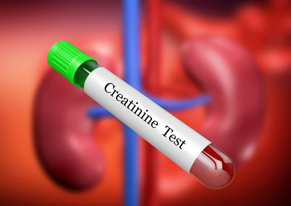 Serum Creatinine Test: Why and How is it Done?