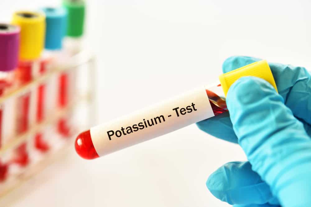 Potassium Test: Why and How Is It Done?